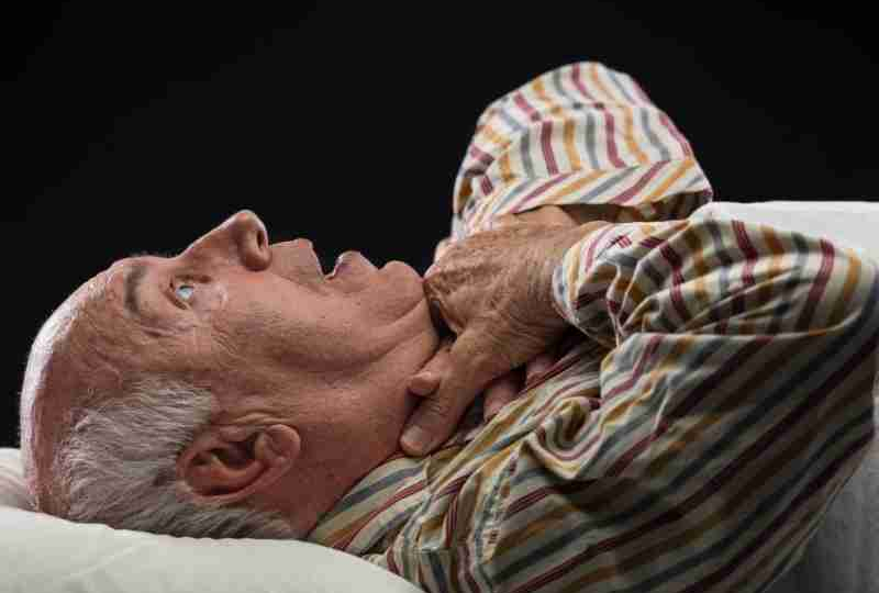 Stroke Iskemik Adalah