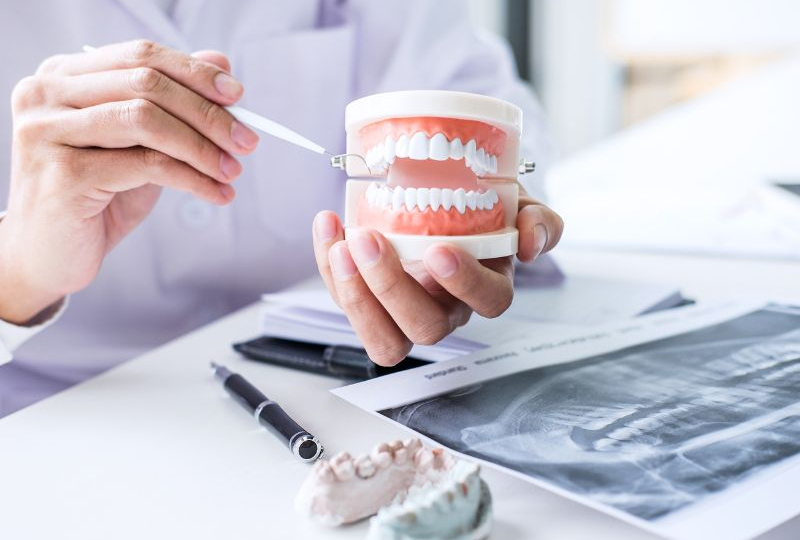 Zinc Oxide Dental Use